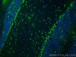 CELSR3 Antibody in Immunohistochemistry (PFA fixed) (IHC (PFA))
