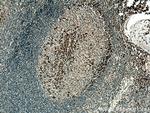 CD1c Antibody in Immunohistochemistry (Paraffin) (IHC (P))
