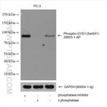 Phospho-GYS1 (Ser641) Antibody in Western Blot (WB)