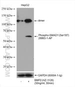 Phospho-SMAD1 (Ser187) Antibody in Western Blot (WB)