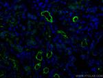 ACE2 Antibody in Immunohistochemistry (Paraffin) (IHC (P))