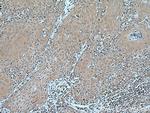 CORO2A Antibody in Immunohistochemistry (Paraffin) (IHC (P))