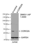 CORO2A Antibody in Western Blot (WB)