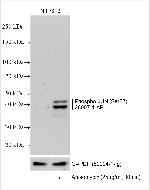 OPRM1 Antibody in Western Blot (WB)