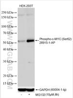 Phospho-c-MYC (Ser62) Antibody in Western Blot (WB)