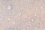 PLA2G4A Antibody in Immunohistochemistry (Paraffin) (IHC (P))