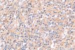 PLA2G4A Antibody in Immunohistochemistry (Paraffin) (IHC (P))