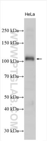 PLA2G4A Antibody in Western Blot (WB)