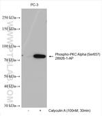 Phospho-PKC Alpha (Ser657) Antibody in Western Blot (WB)