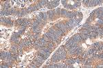 CD46 Antibody in Immunohistochemistry (Paraffin) (IHC (P))