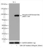 Phospho-STAT5A (Ser726) Antibody in Western Blot (WB)