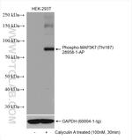 Phospho-MAP3K7 (Thr187) Antibody in Western Blot (WB)