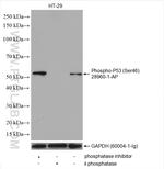 Phospho-P53 (Ser46) Antibody in Western Blot (WB)