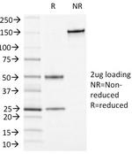 CD13/Aminopeptidase-N (Myeloid Cell Marker) Monoclonal Antibody (APN/1464)