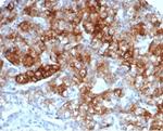 CD13/Aminopeptidase-N (Myeloid Cell Marker) Monoclonal Antibody (APN/6997)