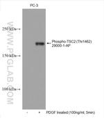 Phospho-TSC2 (Thr1462) Antibody in Western Blot (WB)