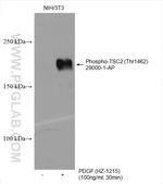 Phospho-TSC2 (Thr1462) Antibody in Western Blot (WB)
