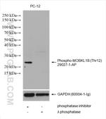 Phospho-MOBKL1B (Thr12) Antibody in Western Blot (WB)