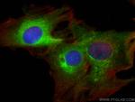CES1 Antibody in Immunocytochemistry (ICC/IF)