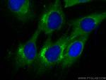 CES1 Antibody in Immunocytochemistry (ICC/IF)