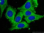 CES1 Antibody in Immunocytochemistry (ICC/IF)
