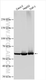 CES1 Antibody in Western Blot (WB)