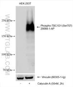 Phospho-TBC1D1 (Ser707) Antibody in Western Blot (WB)
