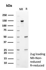 PHPT1 Antibody in SDS-PAGE (SDS-PAGE)