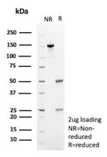 PHPT1 Antibody in SDS-PAGE (SDS-PAGE)