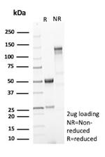 PHPT1 Antibody in SDS-PAGE (SDS-PAGE)