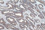 TRMT10C Antibody in Immunohistochemistry (Paraffin) (IHC (P))