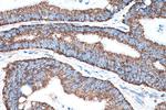 TRMT10C Antibody in Immunohistochemistry (Paraffin) (IHC (P))