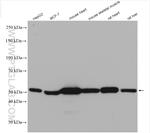 HADHB Antibody in Western Blot (WB)