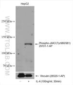 Phospho-JAK3 (Tyr980, Tyr981) Antibody in Western Blot (WB)