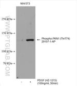 Phospho-PKN1 (Thr774) Antibody in Western Blot (WB)