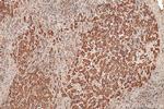 RAB20 Antibody in Immunohistochemistry (Paraffin) (IHC (P))