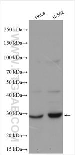 RAB20 Antibody in Western Blot (WB)