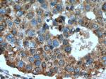 RABIF Antibody in Immunohistochemistry (Paraffin) (IHC (P))
