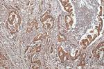 PTH1R Antibody in Immunohistochemistry (Paraffin) (IHC (P))
