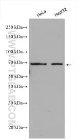 PTH1R Antibody in Western Blot (WB)