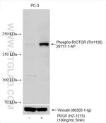 Phospho-RICTOR (Thr1135) Antibody in Western Blot (WB)