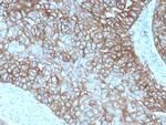 PD-L1/PDCD1LG1/CD274/B7-H1 (Cancer Immunotherapy Target) Antibody in Immunohistochemistry (Paraffin) (IHC (P))