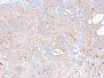 PD-L1/PDCD1LG1/CD274/B7-H1 (Cancer Immunotherapy Target) Antibody in Immunohistochemistry (Paraffin) (IHC (P))