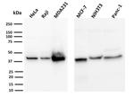 PD-L1/PDCD1LG1/CD274/B7-H1 (Cancer Immunotherapy Target) Monoclonal Antibody (PDL1/2744)