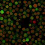 PD-L1/PDCD1LG1/CD274/B7-H1 (Cancer Immunotherapy Target) Monoclonal Antibody (PDL1, 2746)