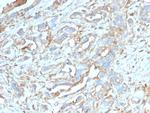 PD-L1/PDCD1LG1/CD274/B7-H1 (Cancer Immunotherapy Target) Antibody in Immunohistochemistry (Paraffin) (IHC (P))