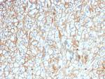 PD-L1/PDCD1LG1/CD274/B7-H1 (Cancer Immunotherapy Target) Antibody in Immunohistochemistry (Paraffin) (IHC (P))