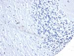 PD-L1/PDCD1LG1/CD274/B7-H1 (Cancer Immunotherapy Target) Recombinant Rabbit Monoclonal Antibody (PDL1, 4280R)