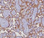 PD-L1/PDCD1LG1/CD274/B7-H1 (Cancer Immunotherapy Target) Recombinant Rabbit Monoclonal Antibody (PDL1/8222R)