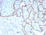 PD-L1/PDCD1LG1/CD274/B7-H1 (Cancer Immunotherapy Target) Recombinant Rabbit Monoclonal Antibody (PDL1/8408R)